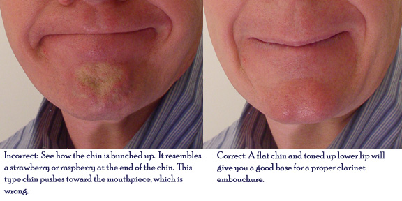 clarinet embouchure strawberry chin